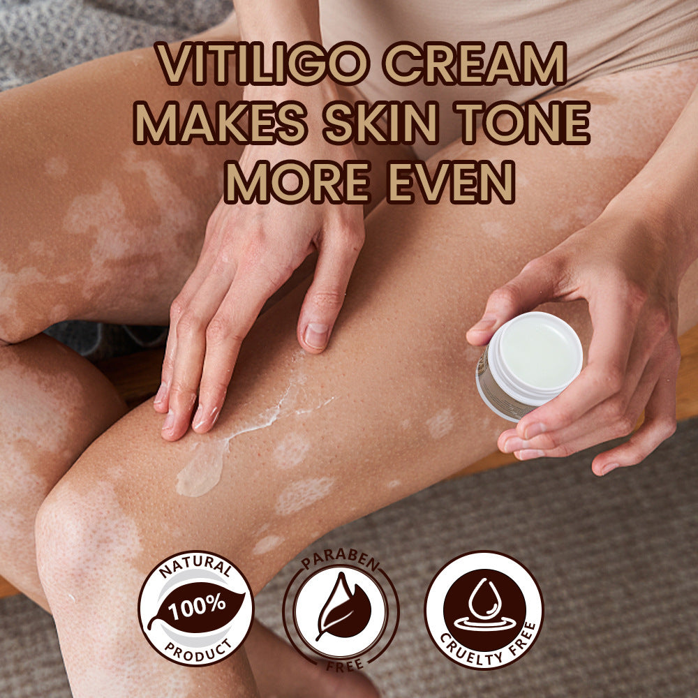 Sumifun White Spot White Skin Antibacterial Cream