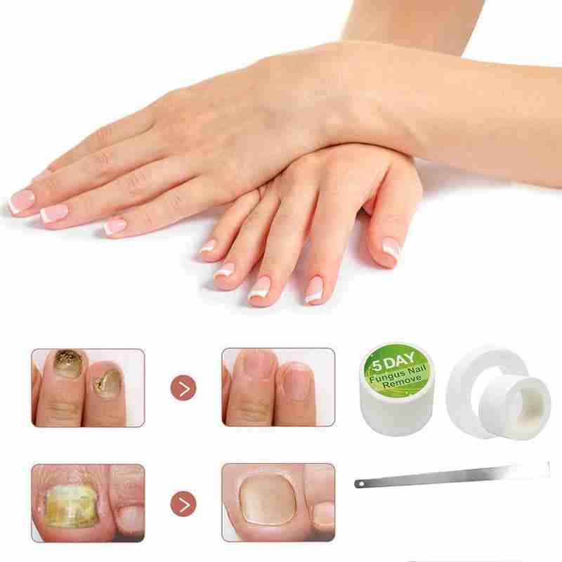 5 day Nail Care Nail Remove Nail Removal Cream Packet