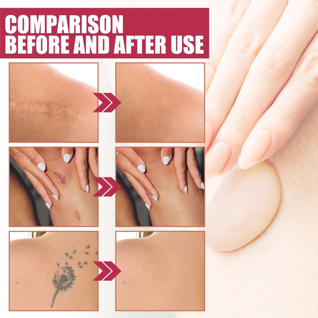 Eelhoe Body Makeup Liquid Foundation Cover Fleck Moisturizing Lasting