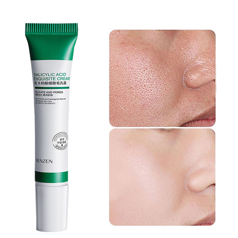 Yenzen Salicylic Acid Pore Refinement Cream Lotion Skin Rejuvenation Cream Skin Care Products