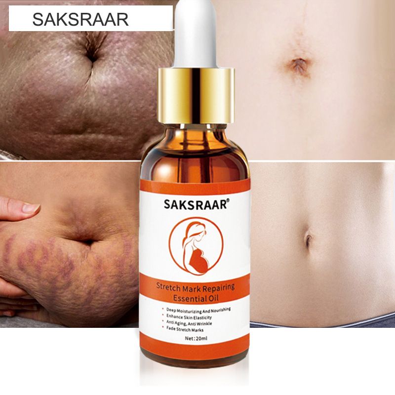 Saksraar tretch Mark Remover Essential Oil Care Cream