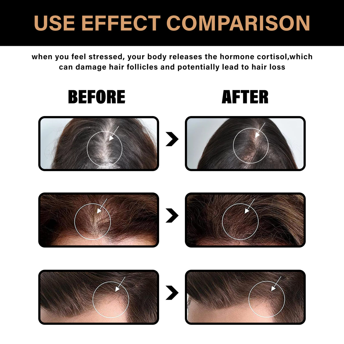 Lunoon Home Men And Women Fashion Simple Dense Hair Shampoo