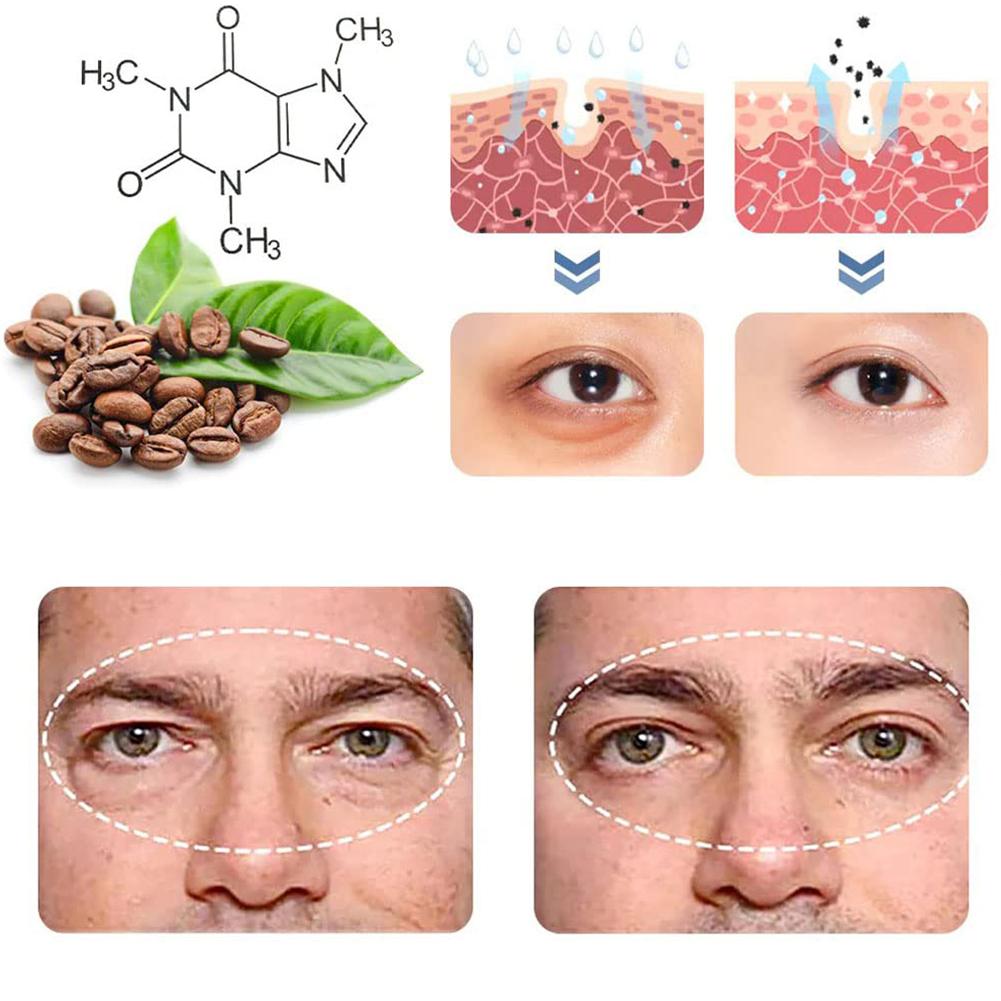 East Moon Openeyes New Anti-aging Eye Cream For Men
