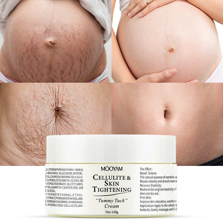 Mooyam Stretch Mark Cream Fat Body Pattern Recovery Cream