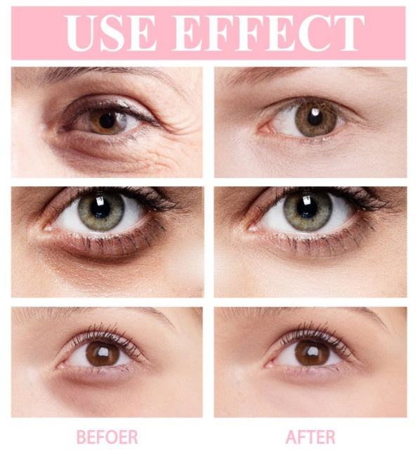 Eelhoe Moisturizing Retinol Eye Cream Stick