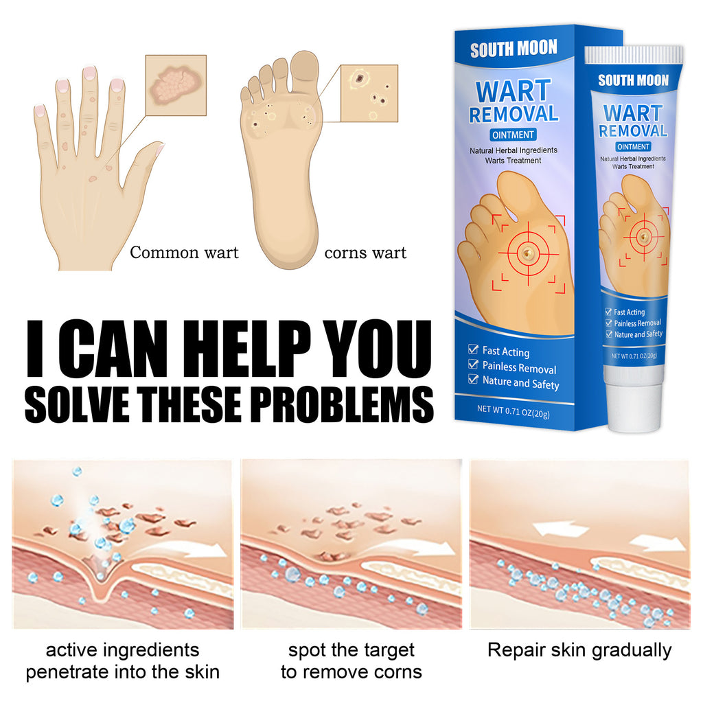 South Moon Remove Corns Cream To Smooth The Calluses