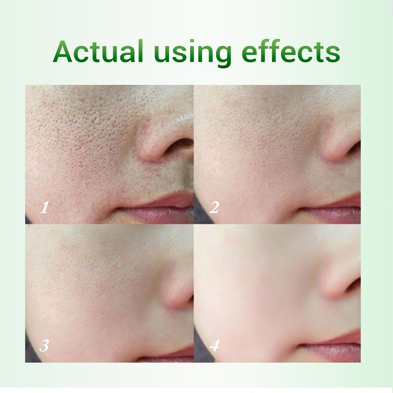 Yenzen Salicylic Acid Pore Refinement Cream Lotion Skin Rejuvenation Cream Skin Care Products