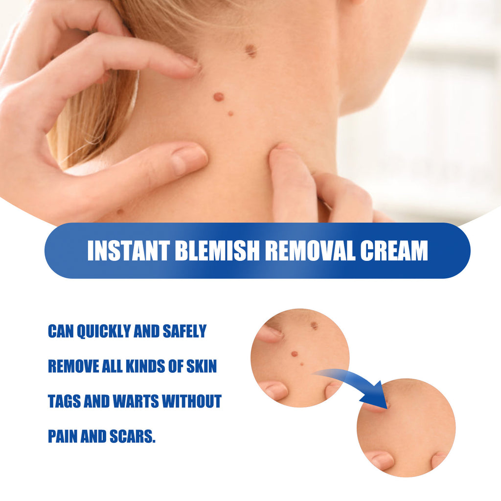 Ouhoe Fade Flesh Bump Pingyou Skin Neck Cream