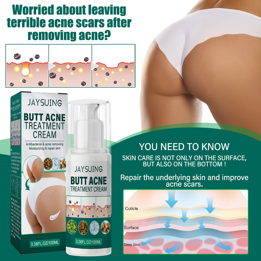 Jaysuing Hip Neck Cream Moisturizing Smallpox Diluting