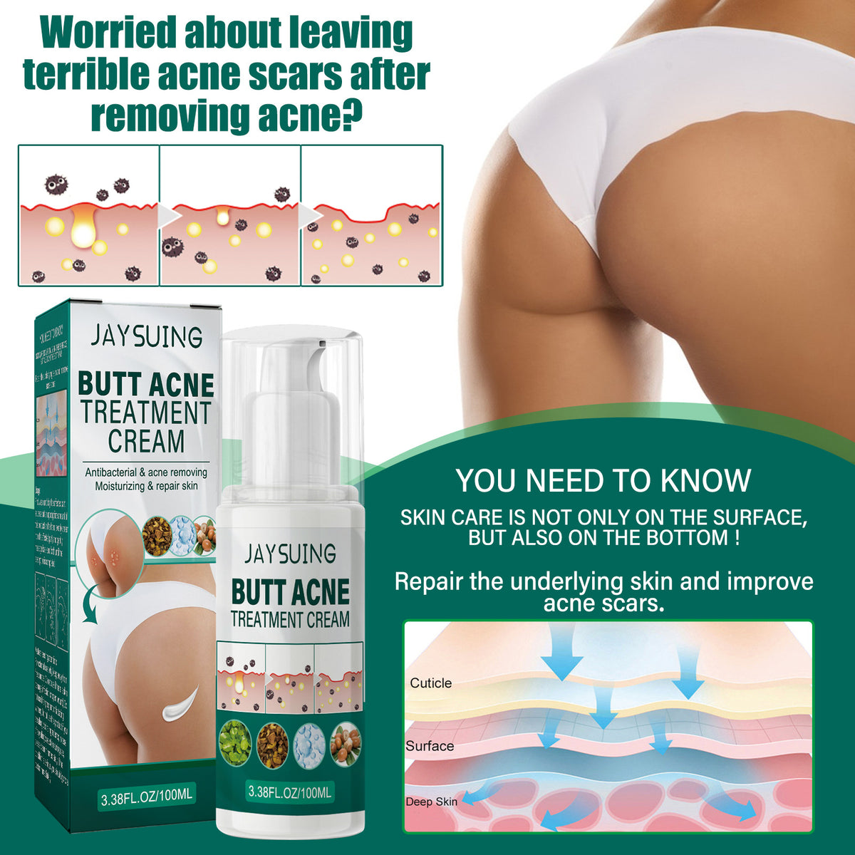 Jaysuing Hip Neck Cream Moisturizing Smallpox Diluting