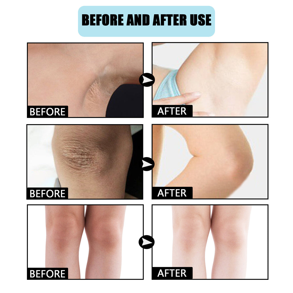 Eelhoe Underarm Moisturizing Concealer Brightening Beauty Cream
