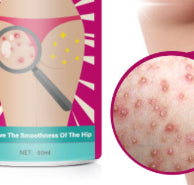 Sauvasine Hip And Leg Blemish Cream Moisturizing