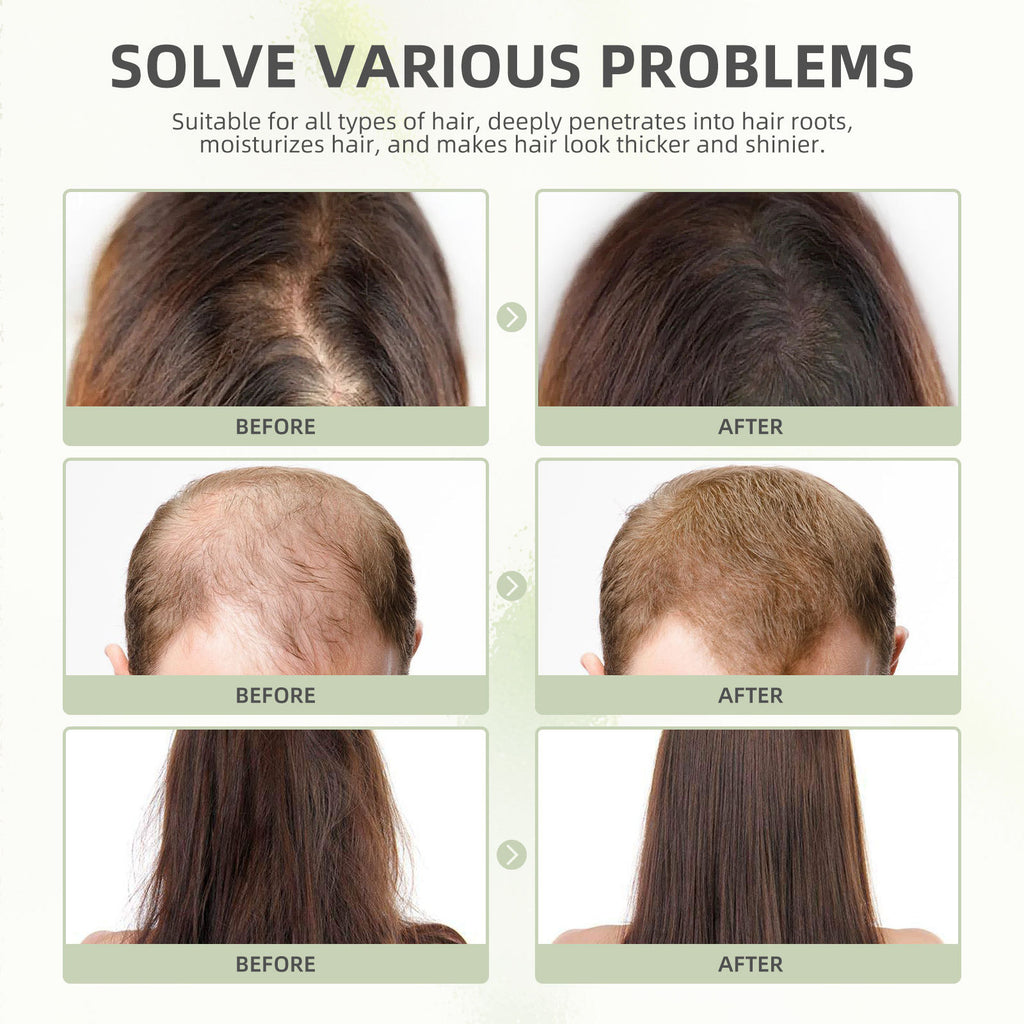 Eelhoe Dense Hair Capsule Nourishing Hair Damage Nourishing