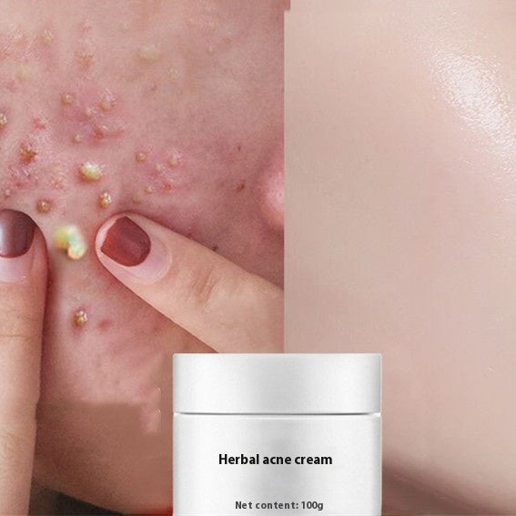 Herbal Lightening Blemish Cream Skin Care