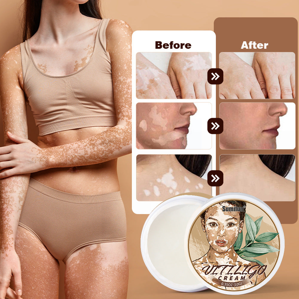 Sumifun White Spot White Skin Antibacterial Cream