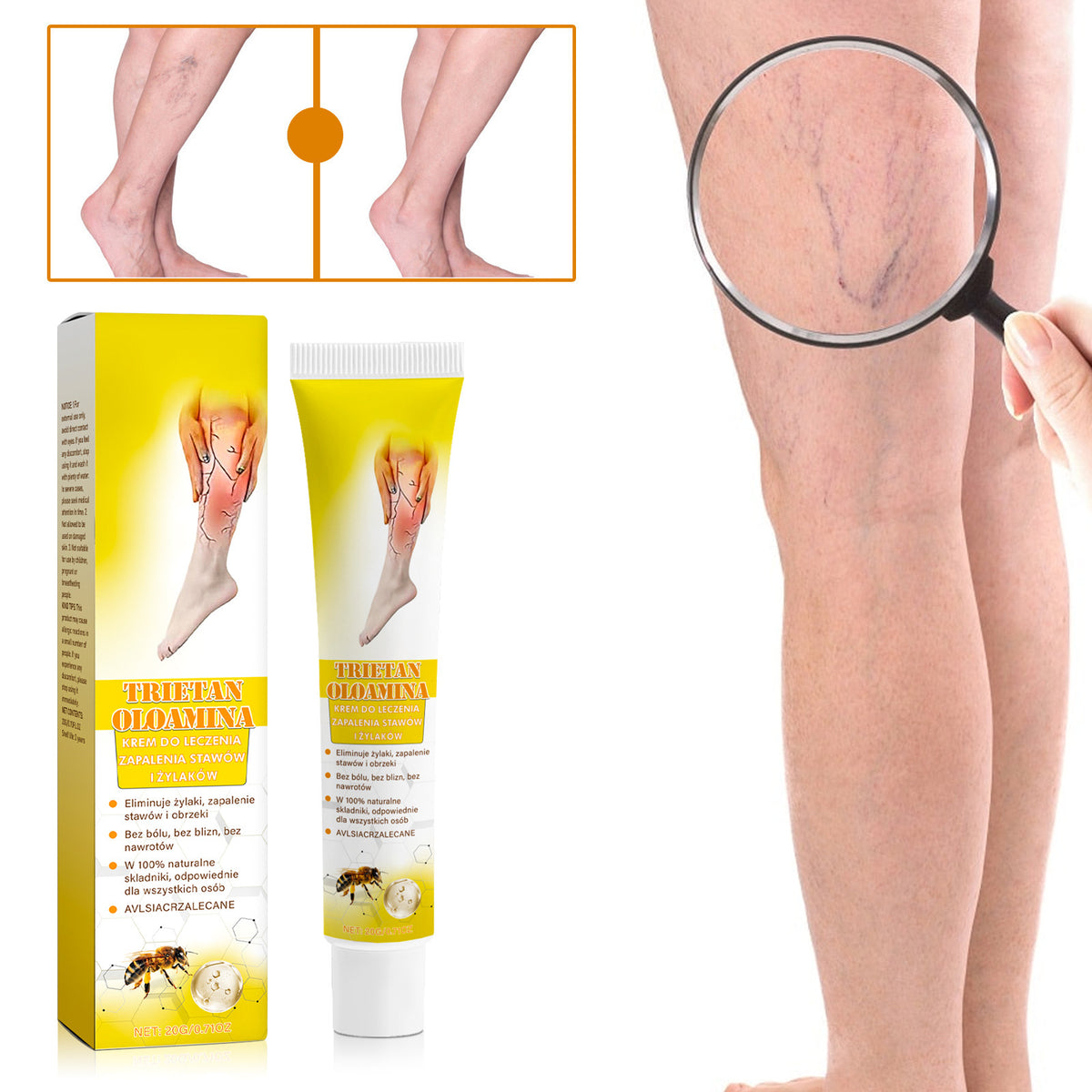 Trietan Oloamine Vein Soothing Cream Relieve Moisturizing