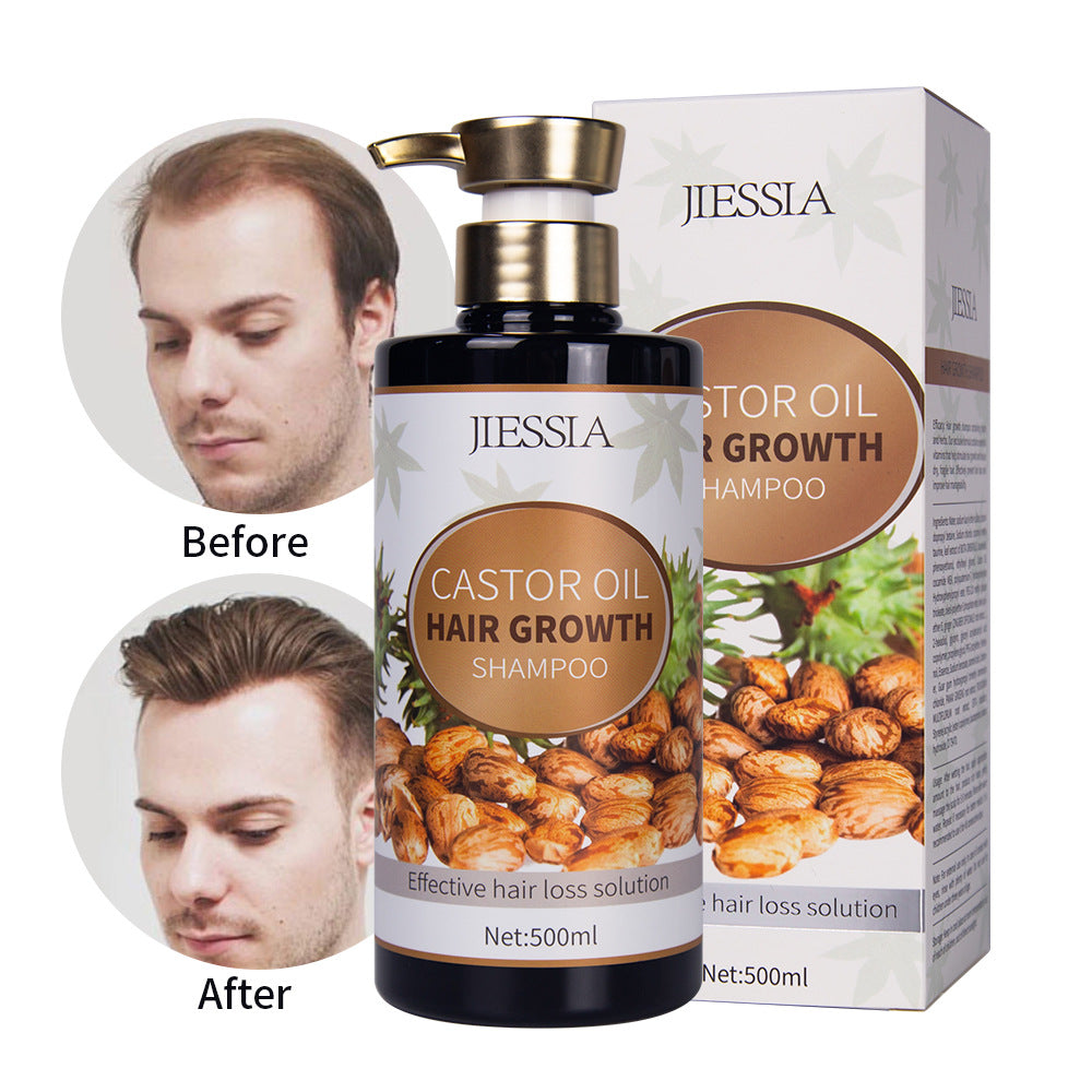 Jiessia Improved Hair Care Plant Nourishing Oil Control Castor Oil Shampoo