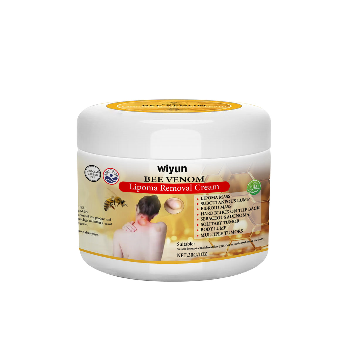 Wiyun Lipoma Removal Cream