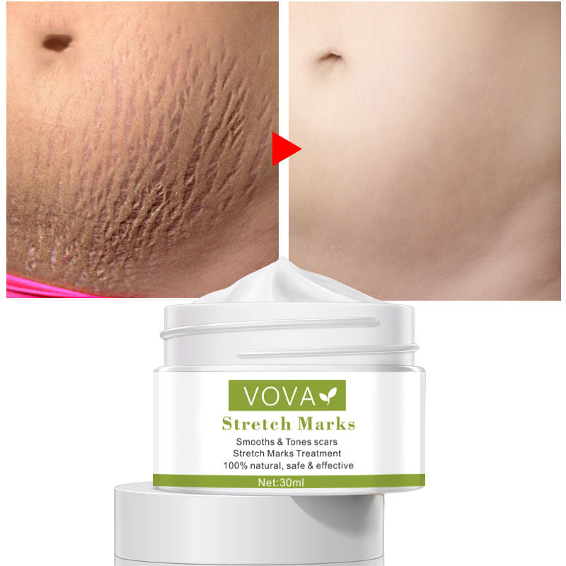 Vova Stretch Marks Pure Color Cream 30ml