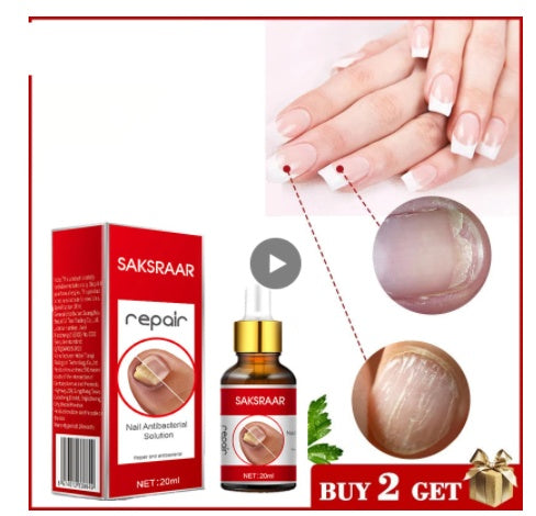 Saksraar Onychomycosis Liquid Nail Removal Cream Soft Liquid