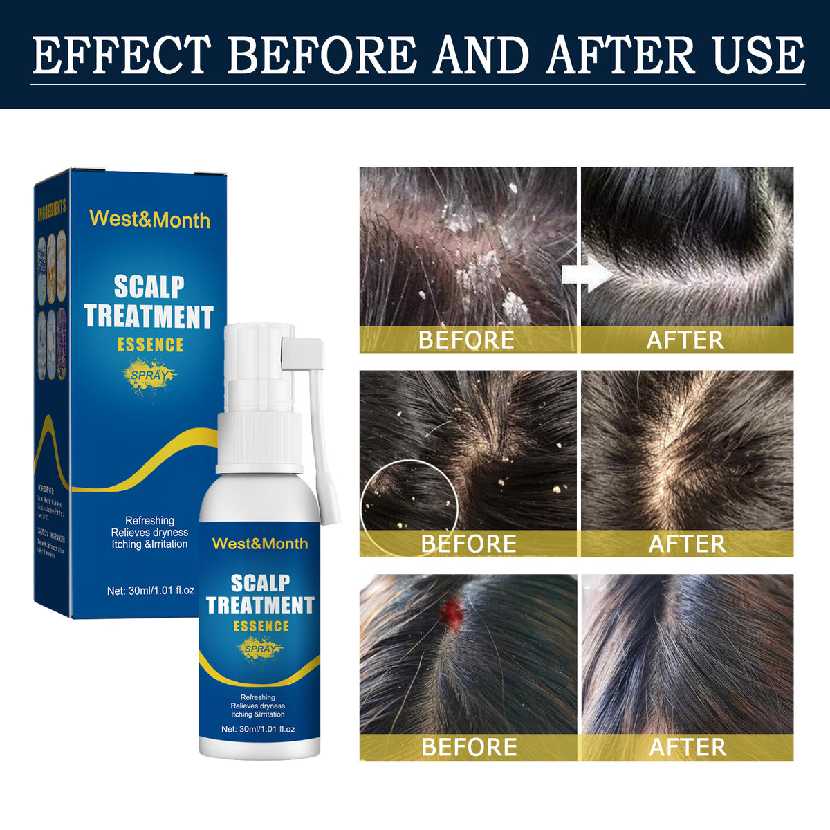 Hair Care Hair Follicle Damage Hair Root Care Spray