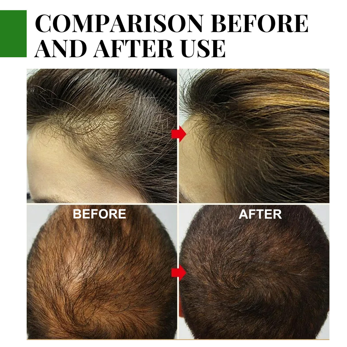 Eelhoe Rosemary Hair Care Essential Oil Anti-loss Hair Growth Hair Care Nourish Scalp Hair Roots