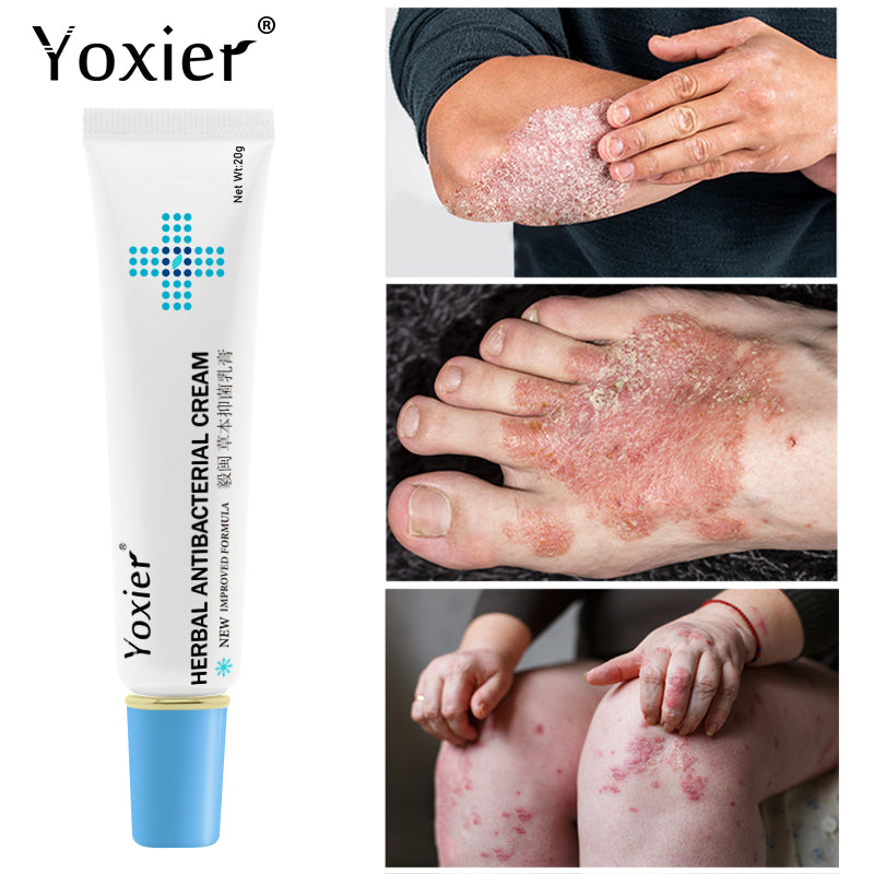 Yoxier Herbal Antibacterial Cream Psoriasis Cream Anti-itch Comfort Eczema Skin Rash Urticaria Desquamation Care