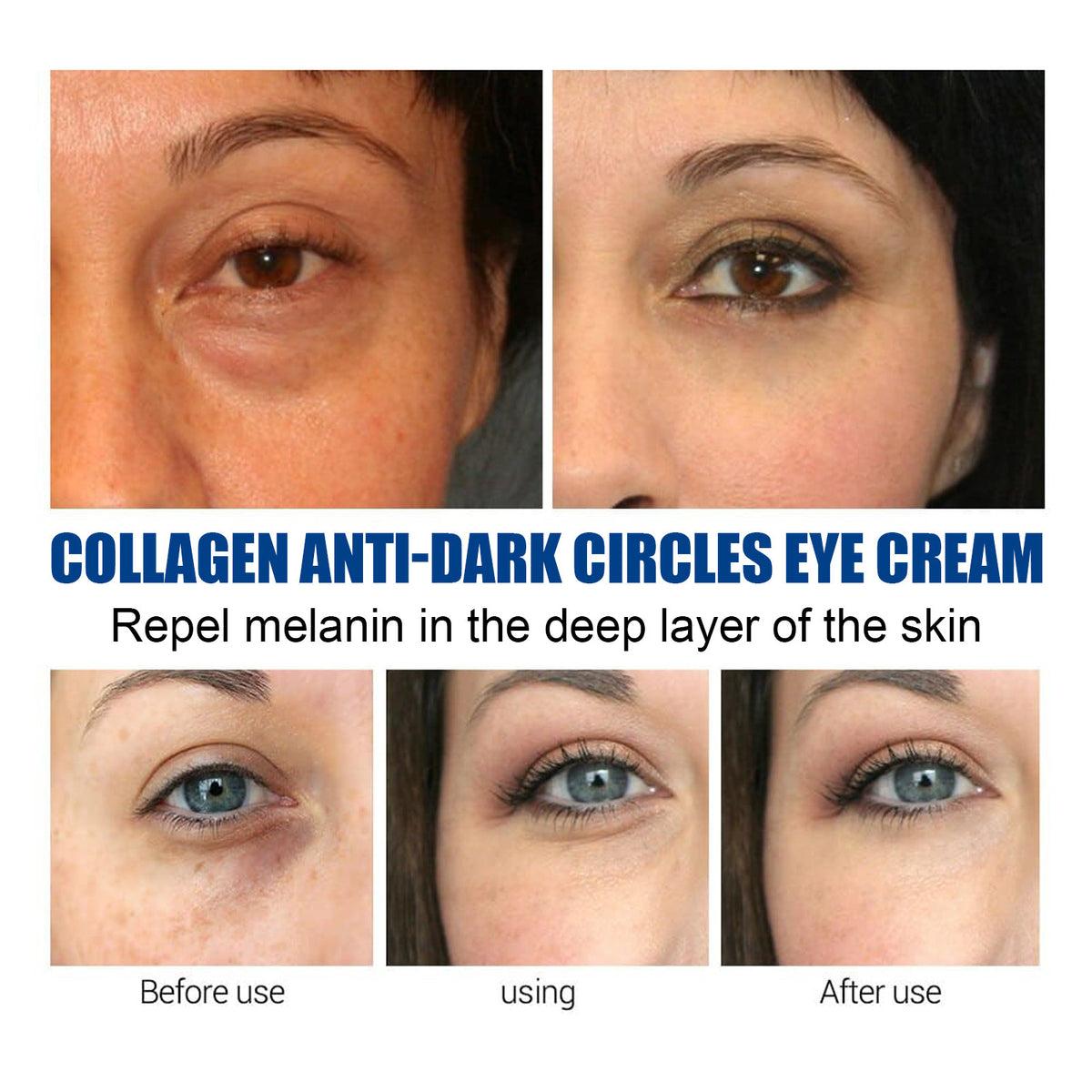 Eelhoe Collagen Dark Circles Eye Cream