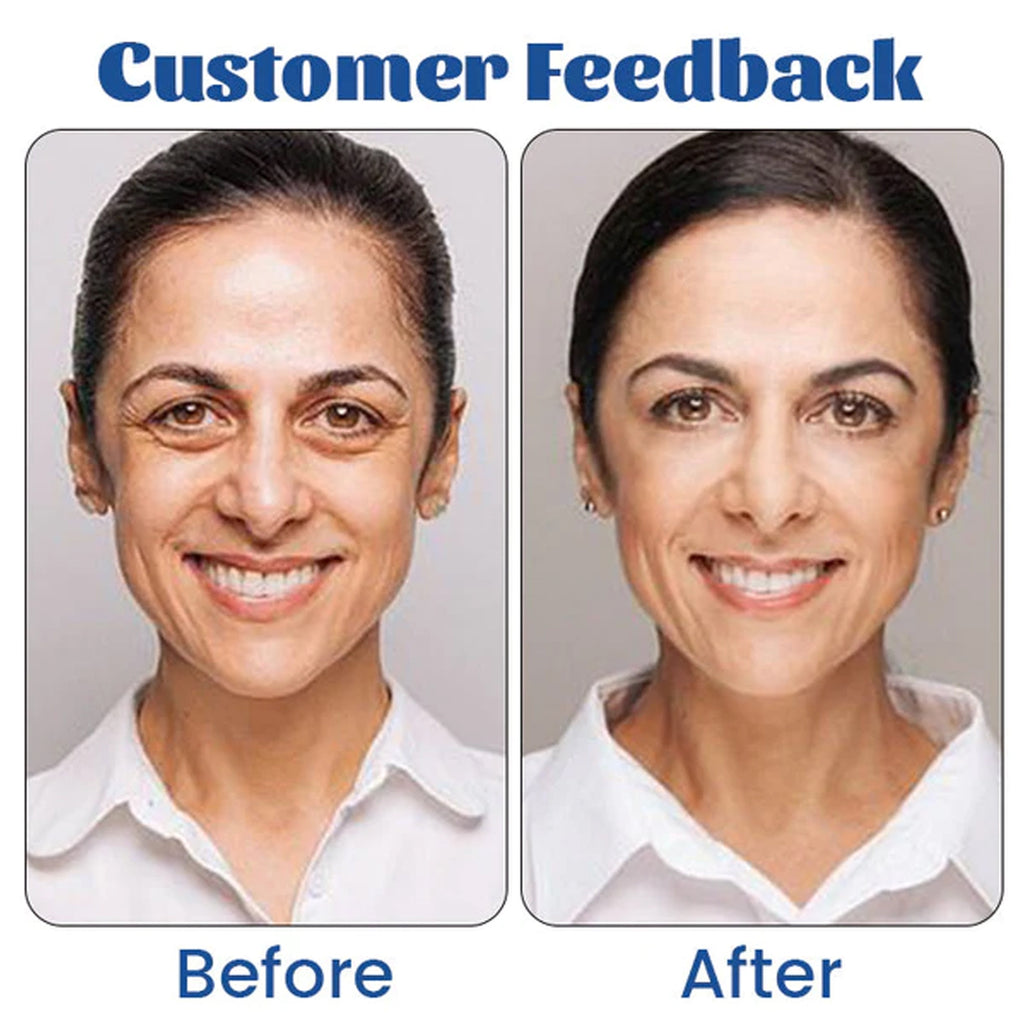 West&Month Retinol Eye Cream Fading Wrinkle