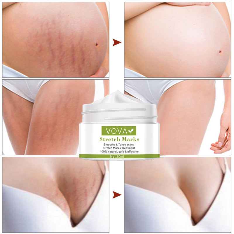 Vova Stretch Marks Pure Color Cream 30ml