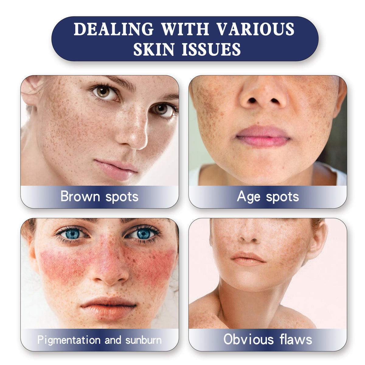 Hoygi Fade Spots Softening Skin Moisturizing Cream