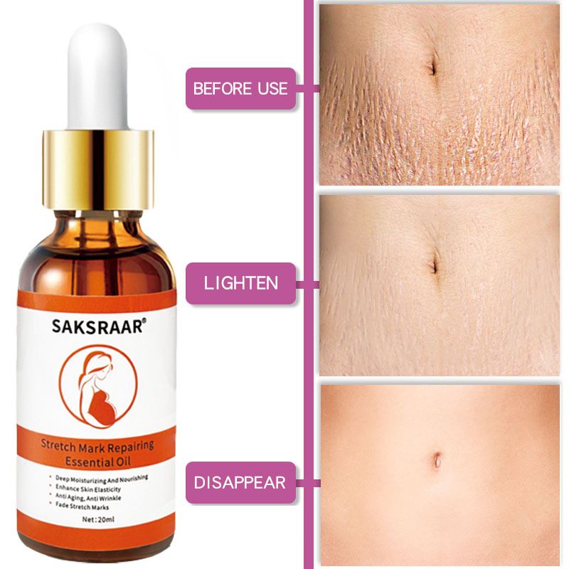 Saksraar tretch Mark Remover Essential Oil Care Cream