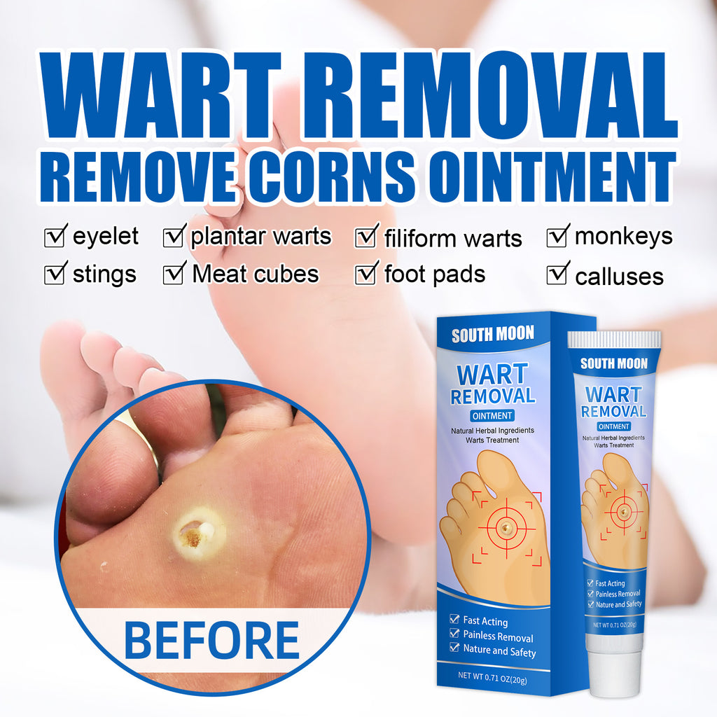 South Moon Remove Corns Cream To Smooth The Calluses