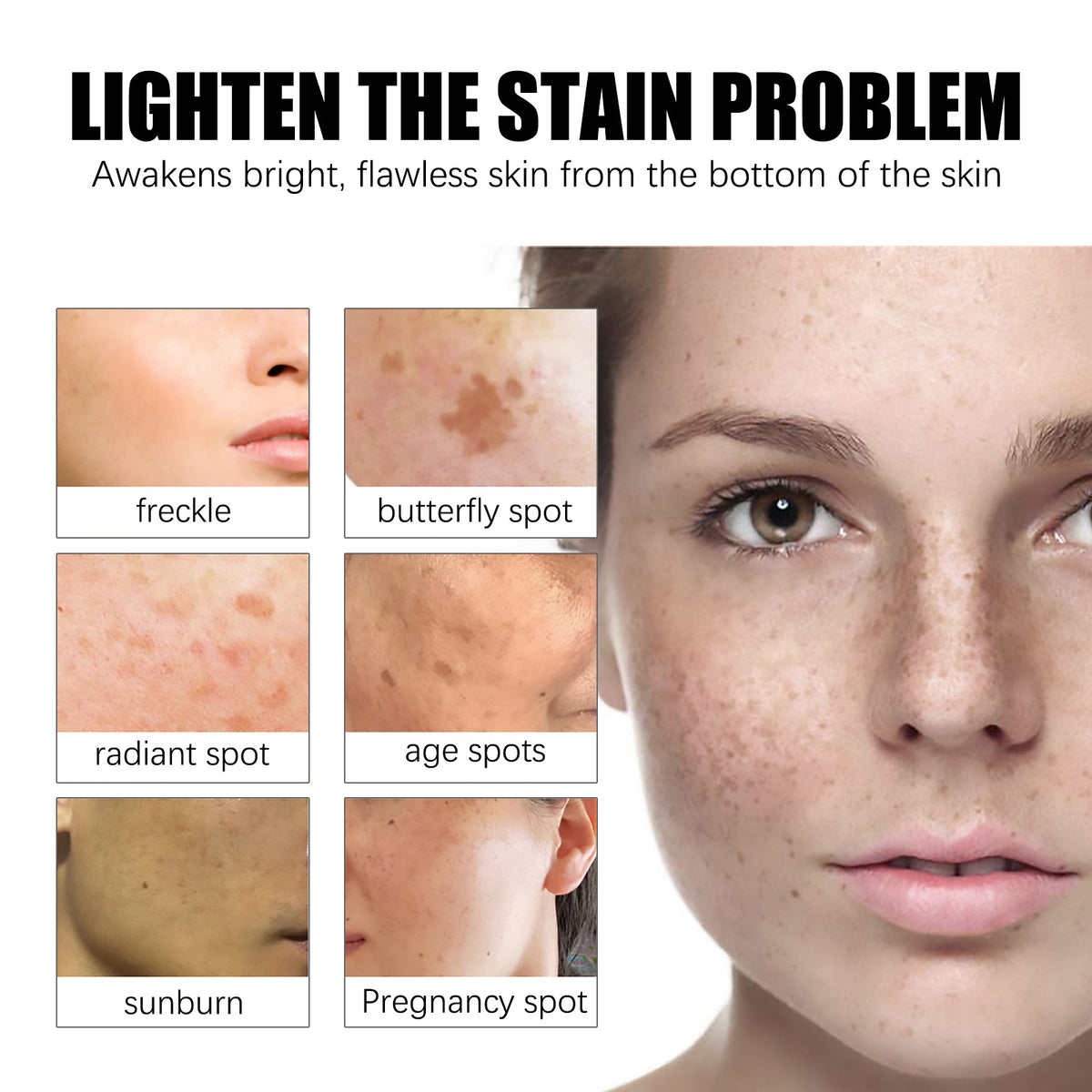 Jaysuing Lighten Spots Green Cream Freckles Decompose Pigments
