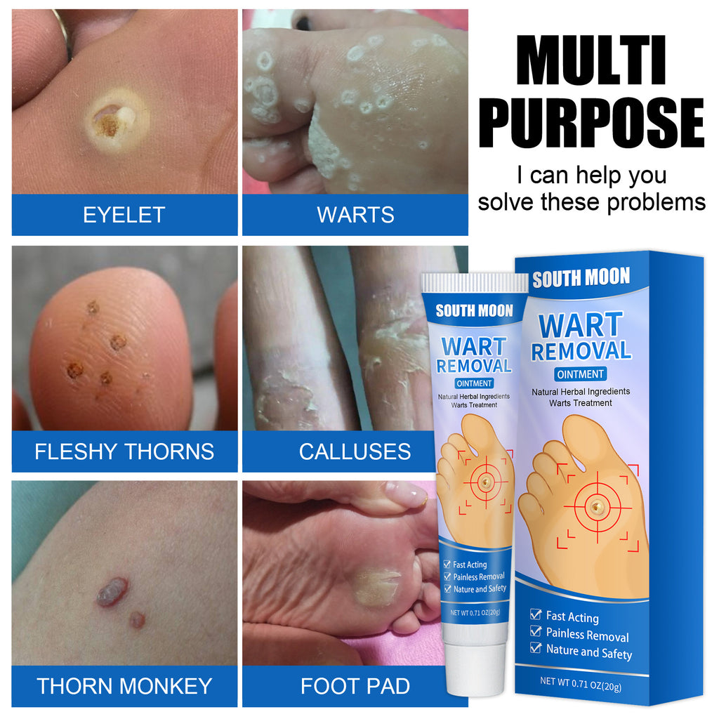 South Moon Remove Corns Cream To Smooth The Calluses