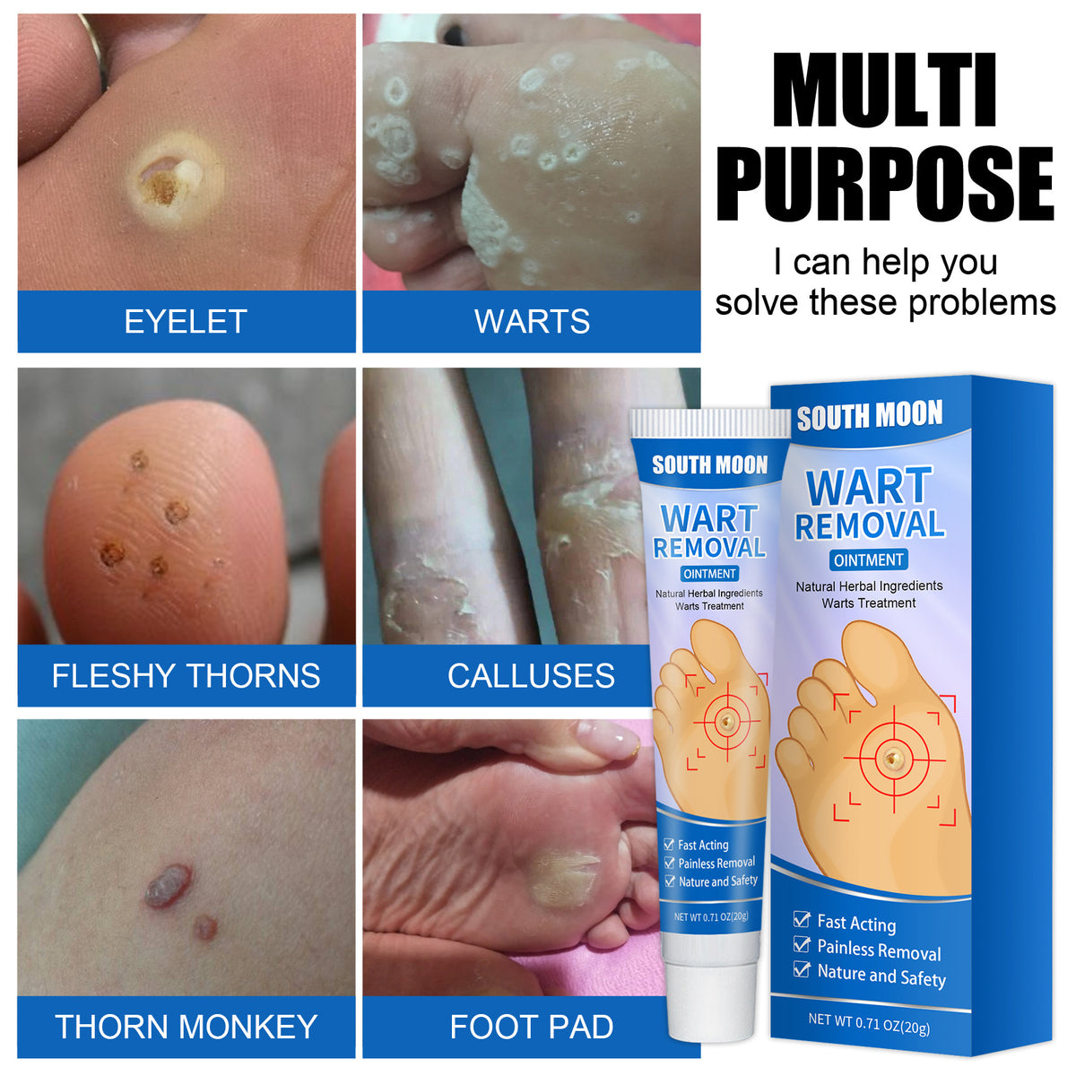 South Moon Remove Corns Cream To Smooth The Calluses