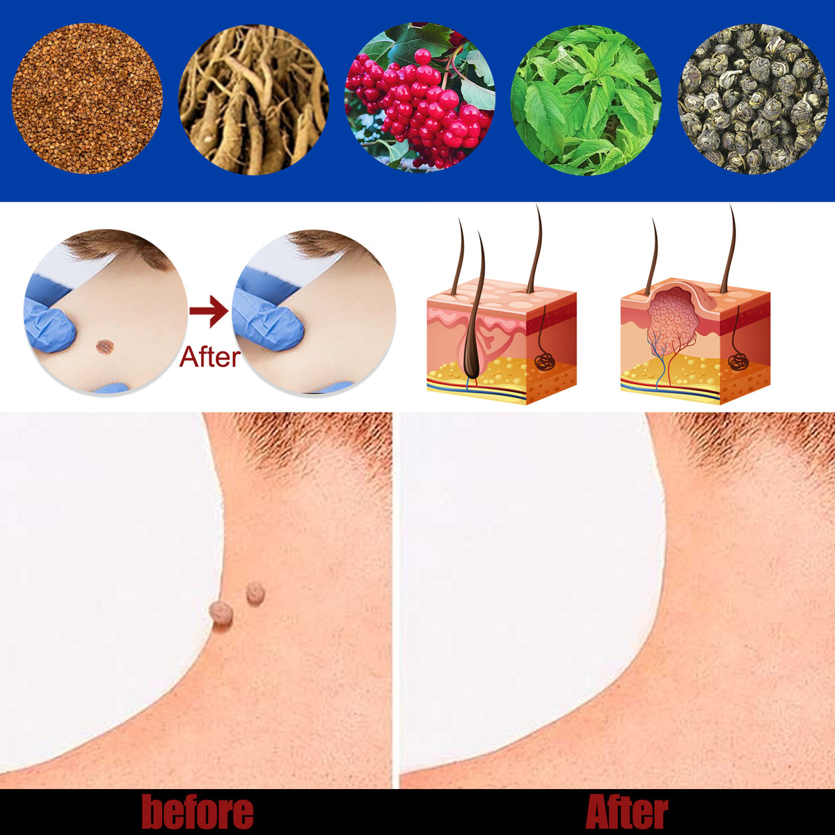 Hand Foot Face Underarm Skin Removing Cream