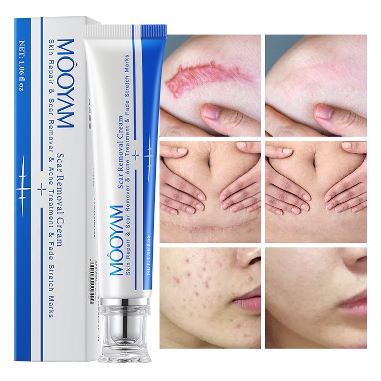 MOOYAM Skin Mark Moisturizing Nourishing Cream