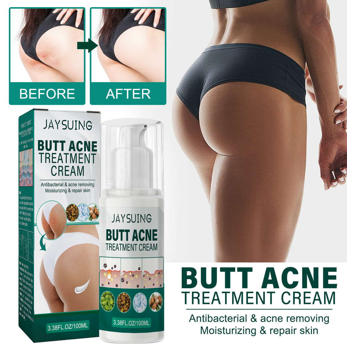 Jaysuing Hip Neck Cream Moisturizing Smallpox Diluting