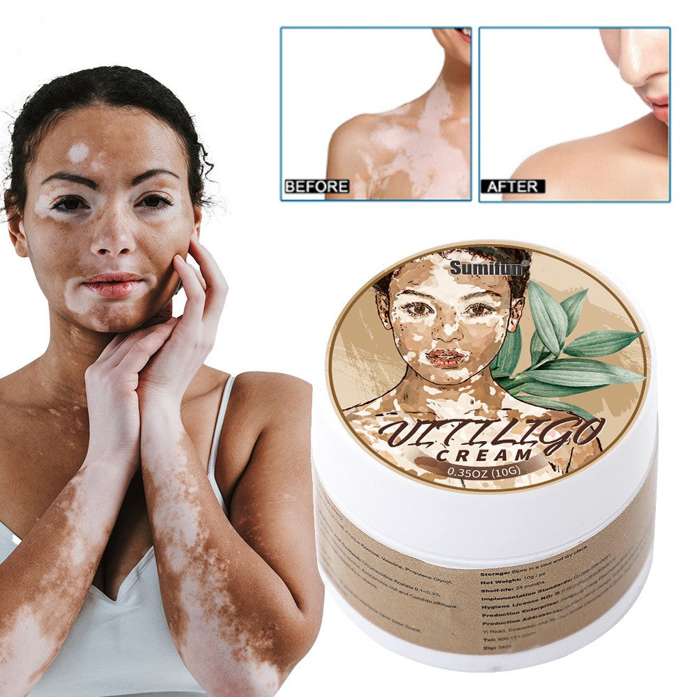 Sumifun White Spot White Skin Antibacterial Cream