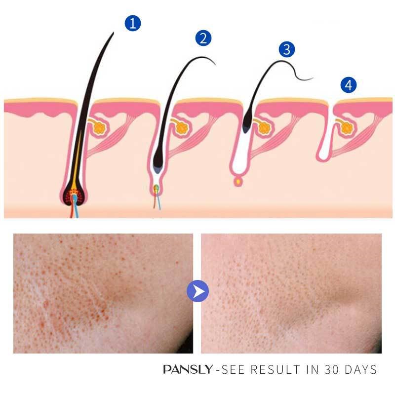 Pansly Hair Growth Inhibition Cream Moustache
