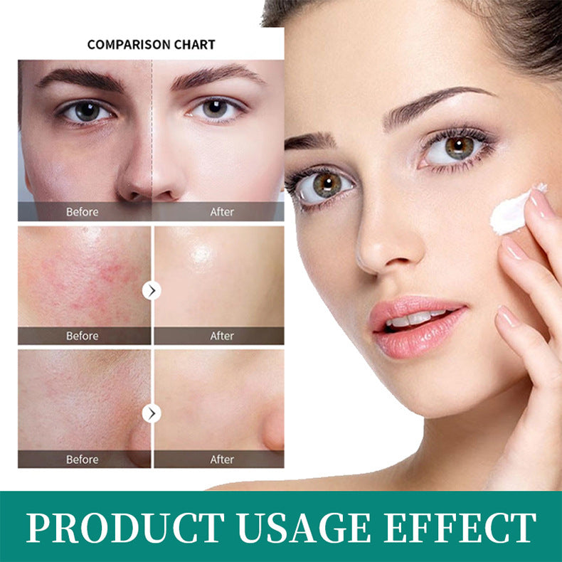 AFCARE Retinol Black Cream Night Cream Moisturizing