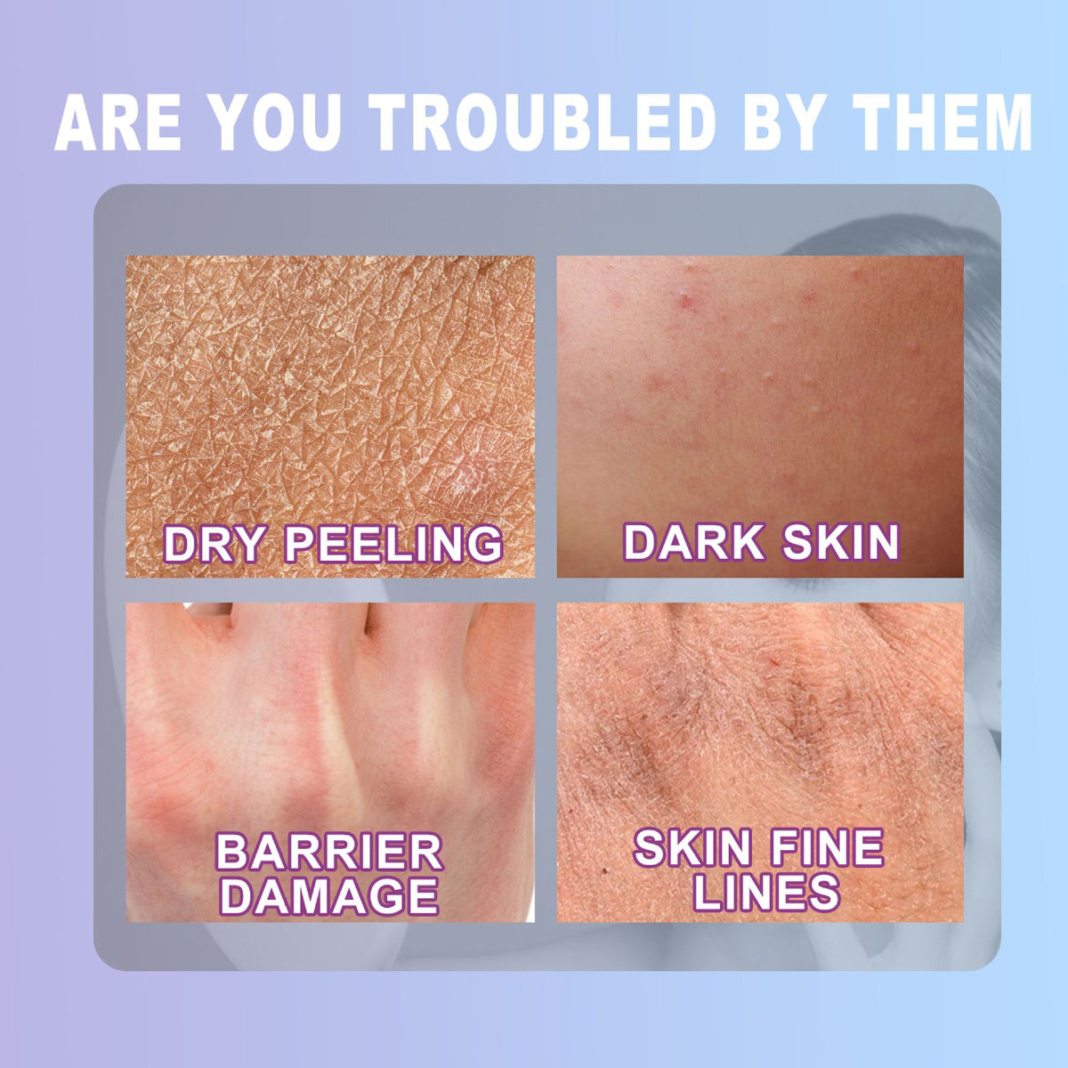 Jaysuing Cracked Hands And Feet Urea Cream Hydrating