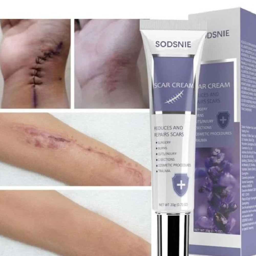Sodsine Advanced Skin Mark Cream 20G