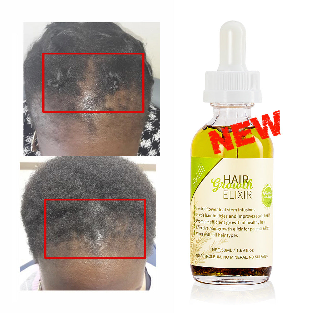 SYULLI Rosemary Nourishing Herbal Hair Oil Hair Renewal Liquid