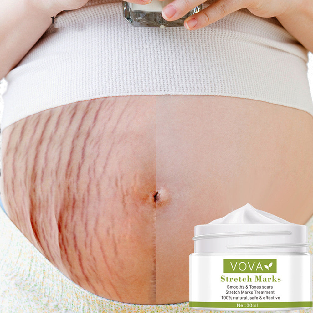 Vova Stretch Marks Pure Color Cream 30ml