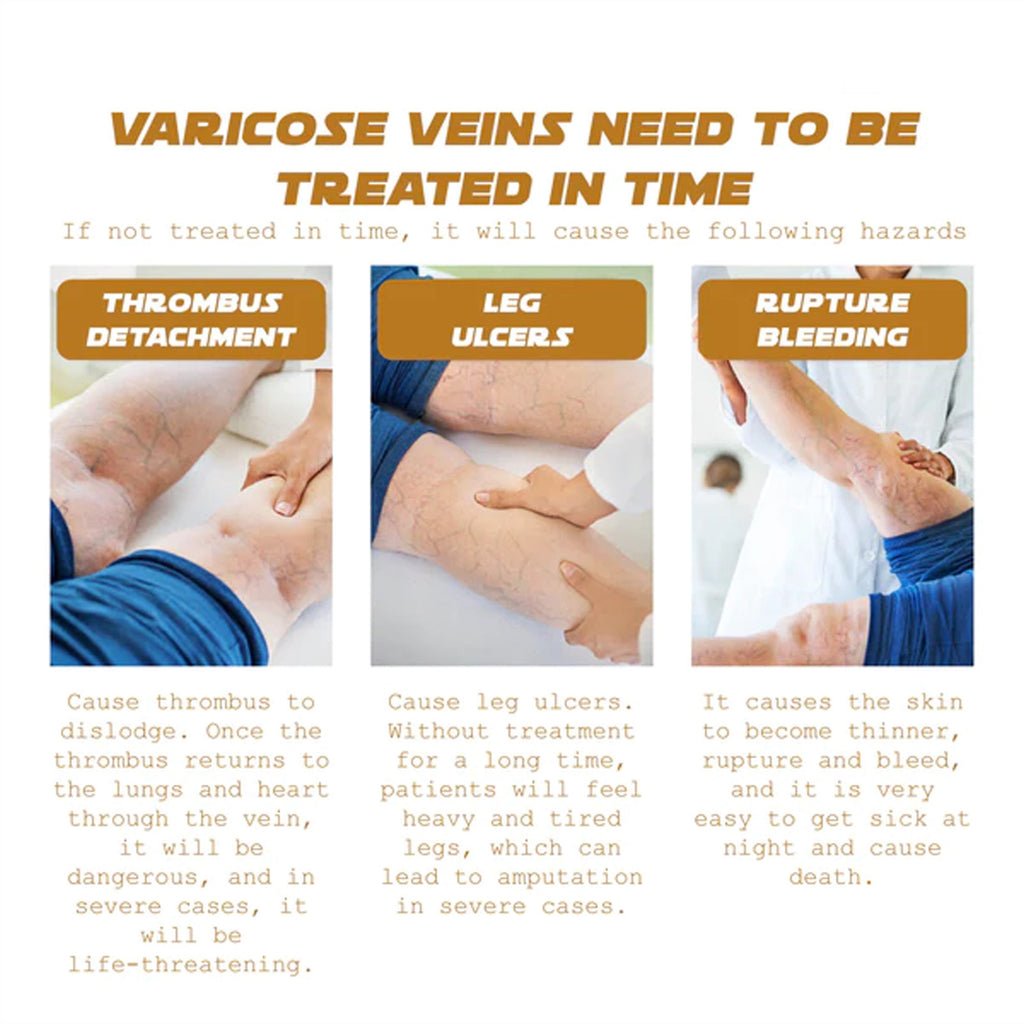 Ximonth Venous Massage Cream To Soothe Sore Legs