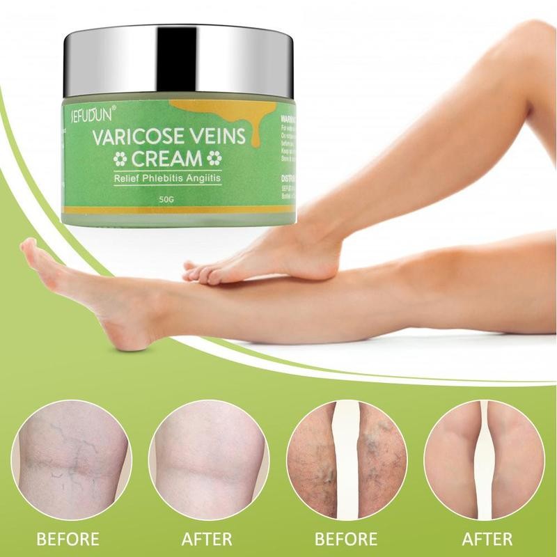 Sefudun Vein Cream Red Blood Streaks Nourishing Earthworm Leg Bruises Bulge Comfort Safflower Skin care lotion Varicose Cream