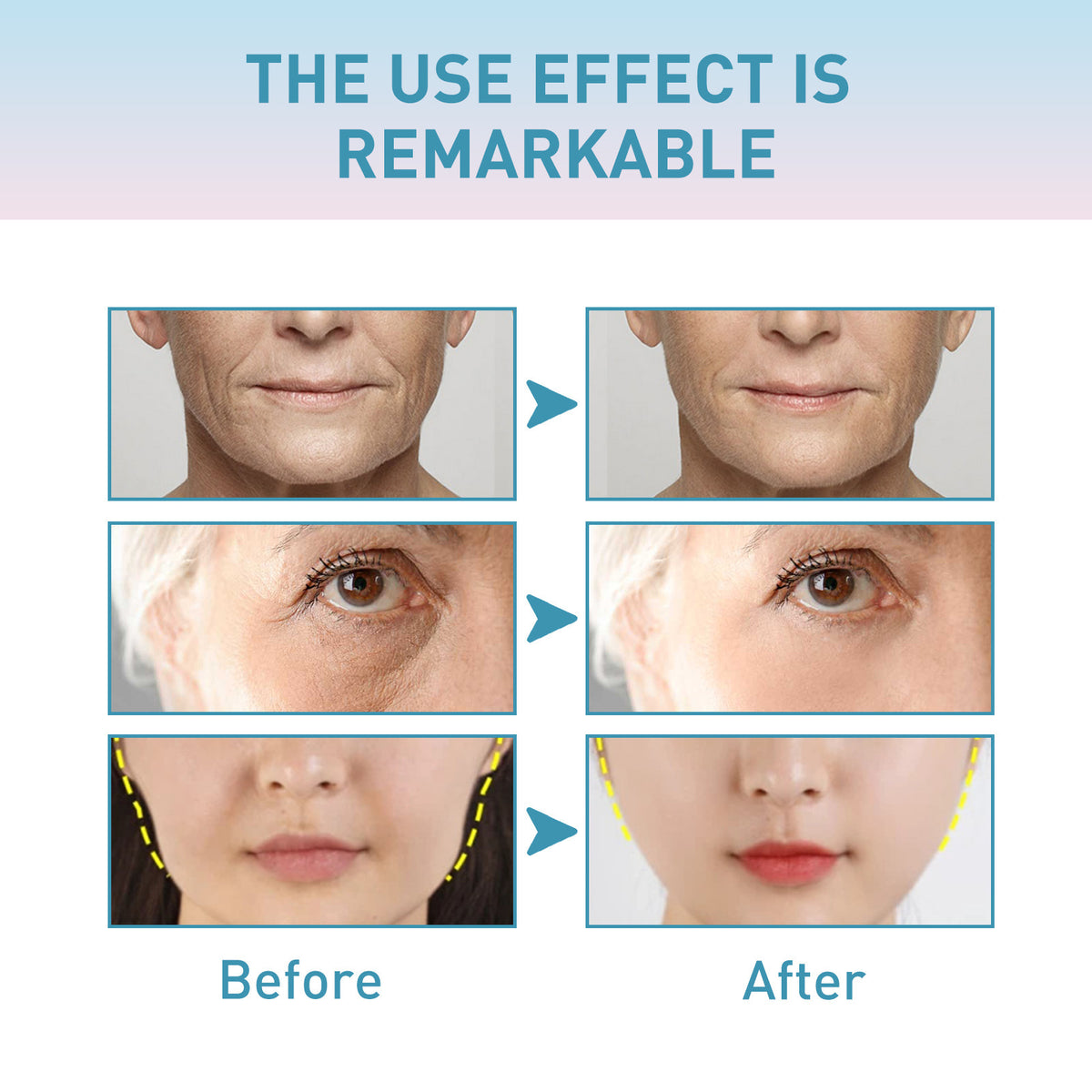 Ouhoe Fading Wrinkle Collagen Anti-wrinkle Face Cream
