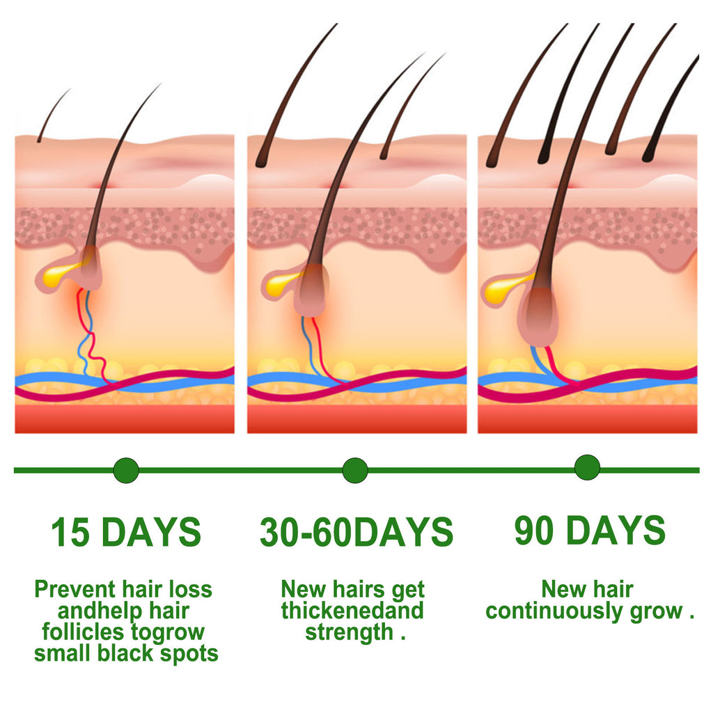 Eelhoe Rosemary Hair Care Essential Oil Anti-loss Hair Growth Hair Care Nourish Scalp Hair Roots